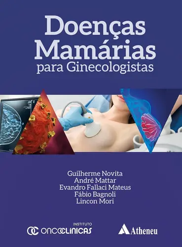 Doenças Mamárias para Ginecologistas