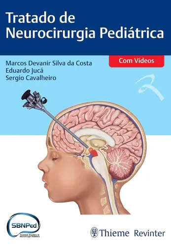 Tratado de Neurocirurgia Pediátrica (Com vídeos)