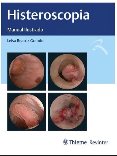 Histeroscopia: Manual Ilustrado.