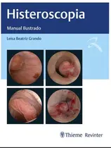 Histeroscopia: Manual Ilustrado.