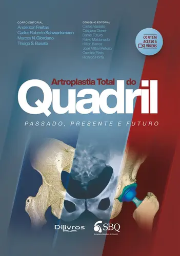 Artroplastia Total do Quadril – Passado, Presente e Futuro