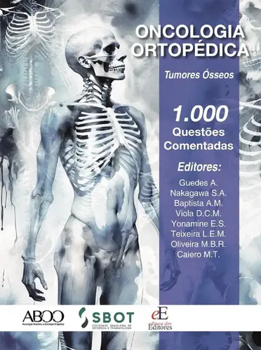 Oncologia Ortopédica Tumores Ósseos: 1.000 questões comentadas