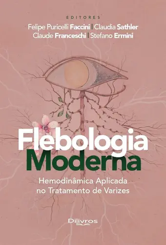 Flebologia Moderna: Hemodinâmica Aplicada No Tratamento De Varizes