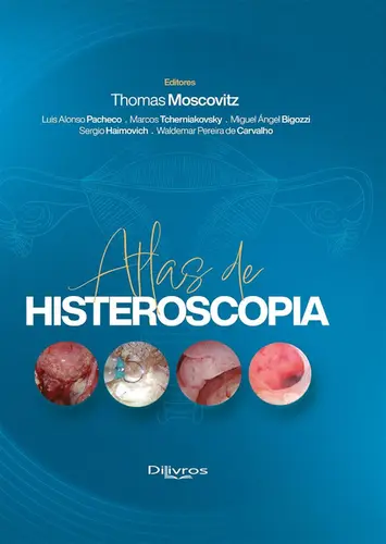 Atlas de Histeroscopia