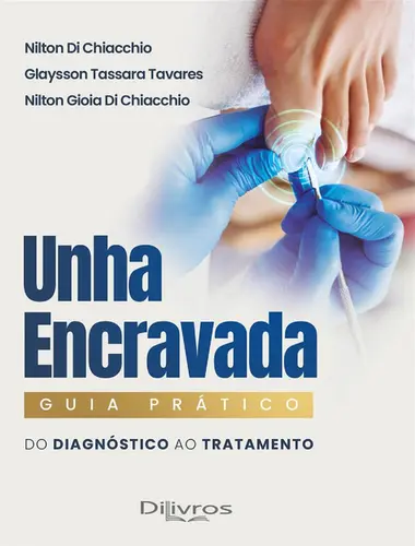 Unha Envravada. Guia Prático: Do Diagnóstico ao Tratamento
