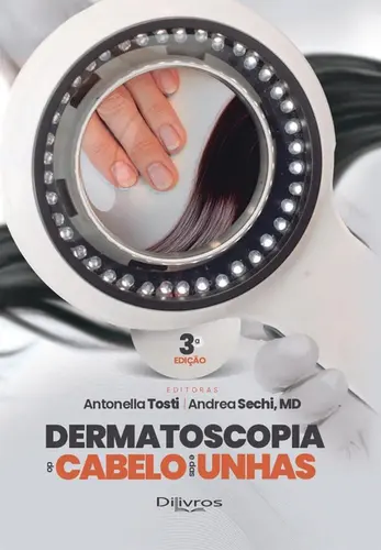 Dermatoscopia Do Cabelo E Das Unhas 3ª Edição