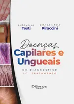 Doenças Capilares E Ungueais: Do Diagnóstico Ao Tratamento