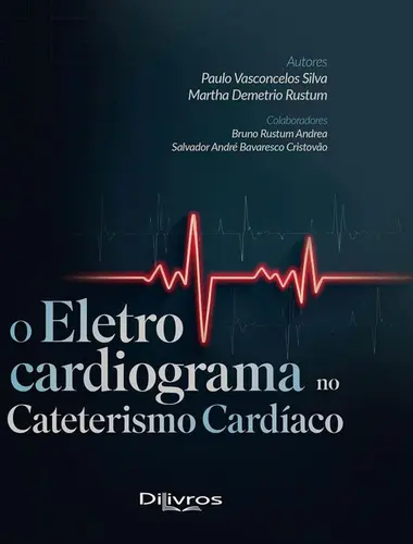 O Eletrocardiograma No Cateterismo Cardíaco