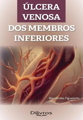 Úlcera Venosa dos Membros Inferiores