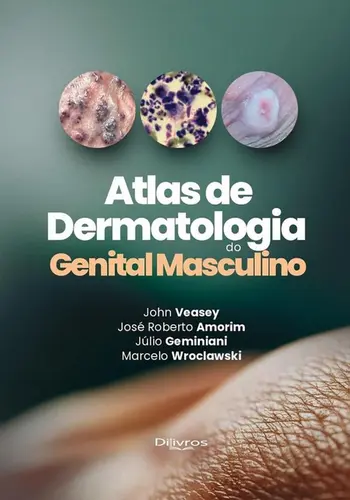 Atlas De Dermatologia Do Genital Masculino