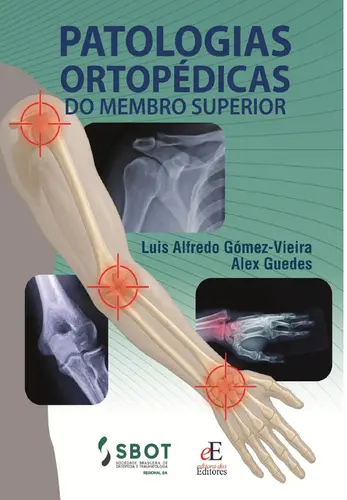 Patologias Ortopedicas Do Membro Superior