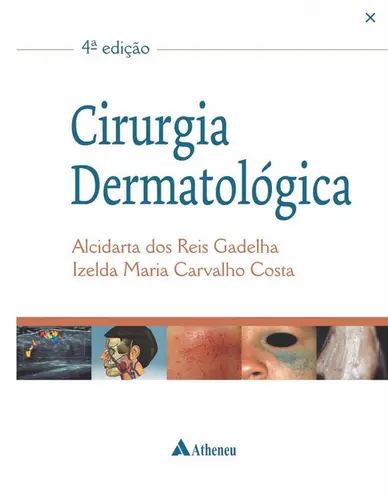 Cirurgia Dermatologica - 4ª Edição